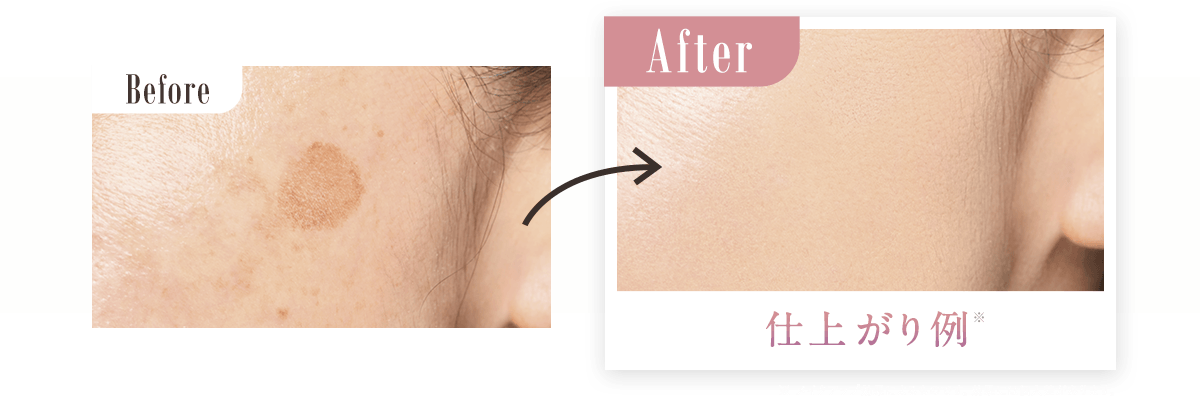 Before→After画像 ※メイクアップ効果によるものです。効果には個人差があります。