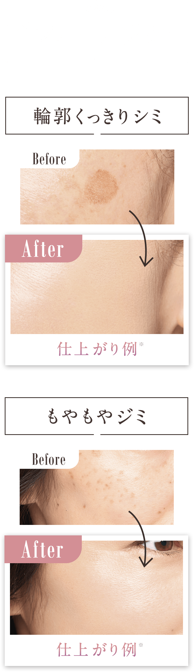 ビフォーアフター